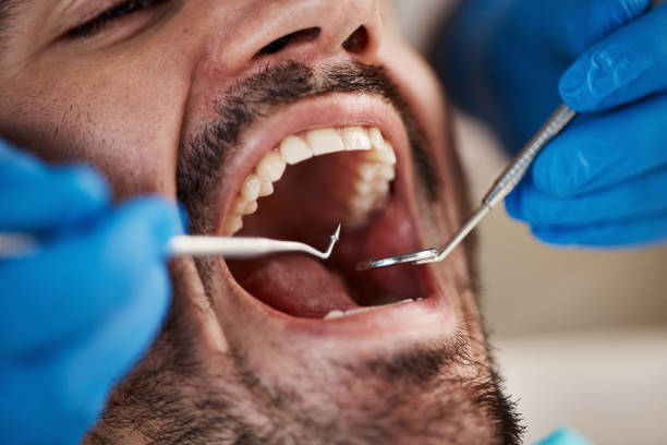 Best Dental Abscess Treatment in Hudson, IL