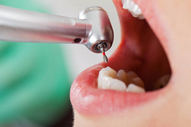 Best Emergency Treatment for Oral Infections in Hudson, IL